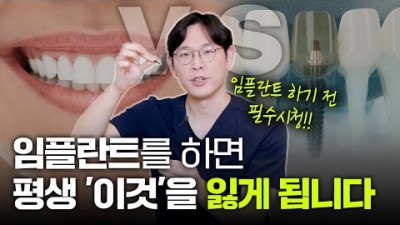 치아 전체를 다 빼고 임플란트로 대체할 수 있을까 자연치아 임플란트 비교 당신의 선택